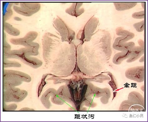 禽距裂|最佳推荐 